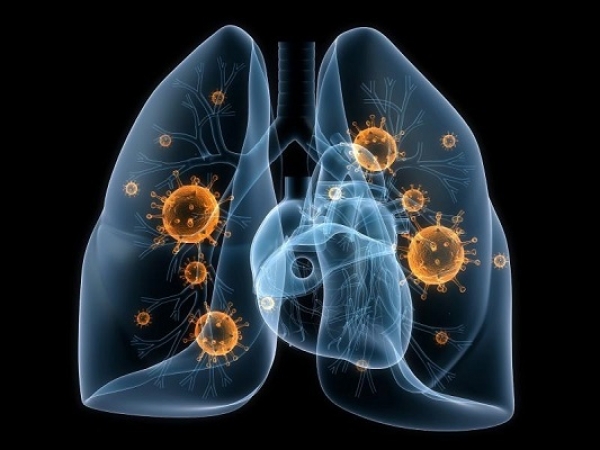 La pneumonie tue plus d&#039;enfants que le paludisme, le VIH / sida et la rougeole combinés