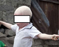 Un enfant albinos (image d&#039;archive à titre d&#039;ullustration, DR)