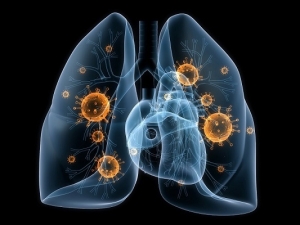 Côte d’Ivoire : Un atelier pour renforcer la résilience des communautés contre la pneumonie