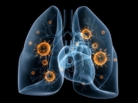Côte d’Ivoire : Un atelier pour renforcer la résilience des communautés contre la pneumonie
